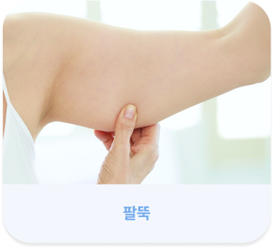手機版溶脂針可施術部位 - 手臂