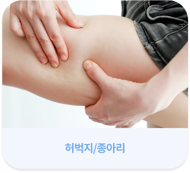 手機版溶脂針可施術部位 - 大腿／小腿